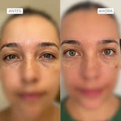 Complejo antiedad contorno de ojos 18ml
