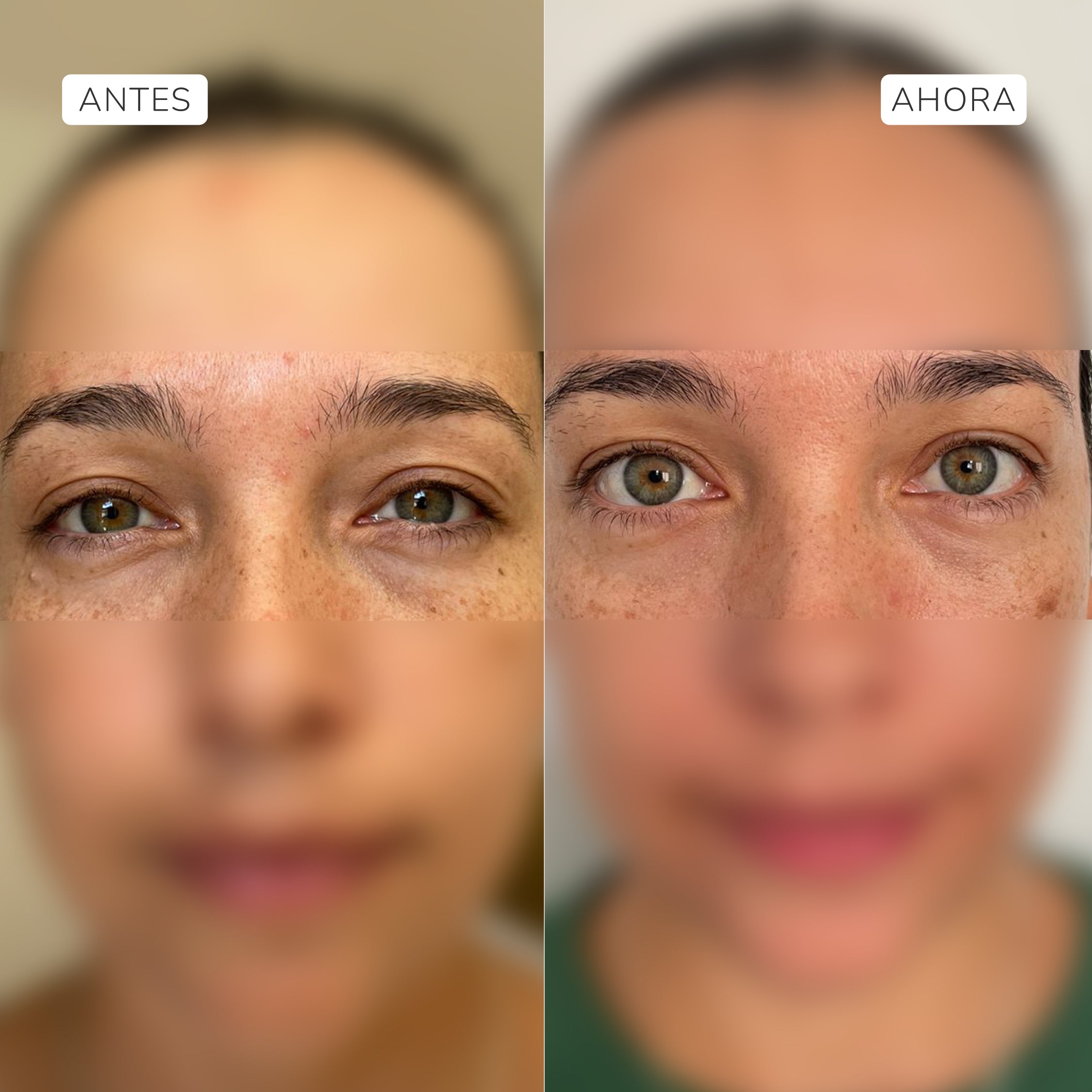Complejo antiedad contorno de ojos 18ml