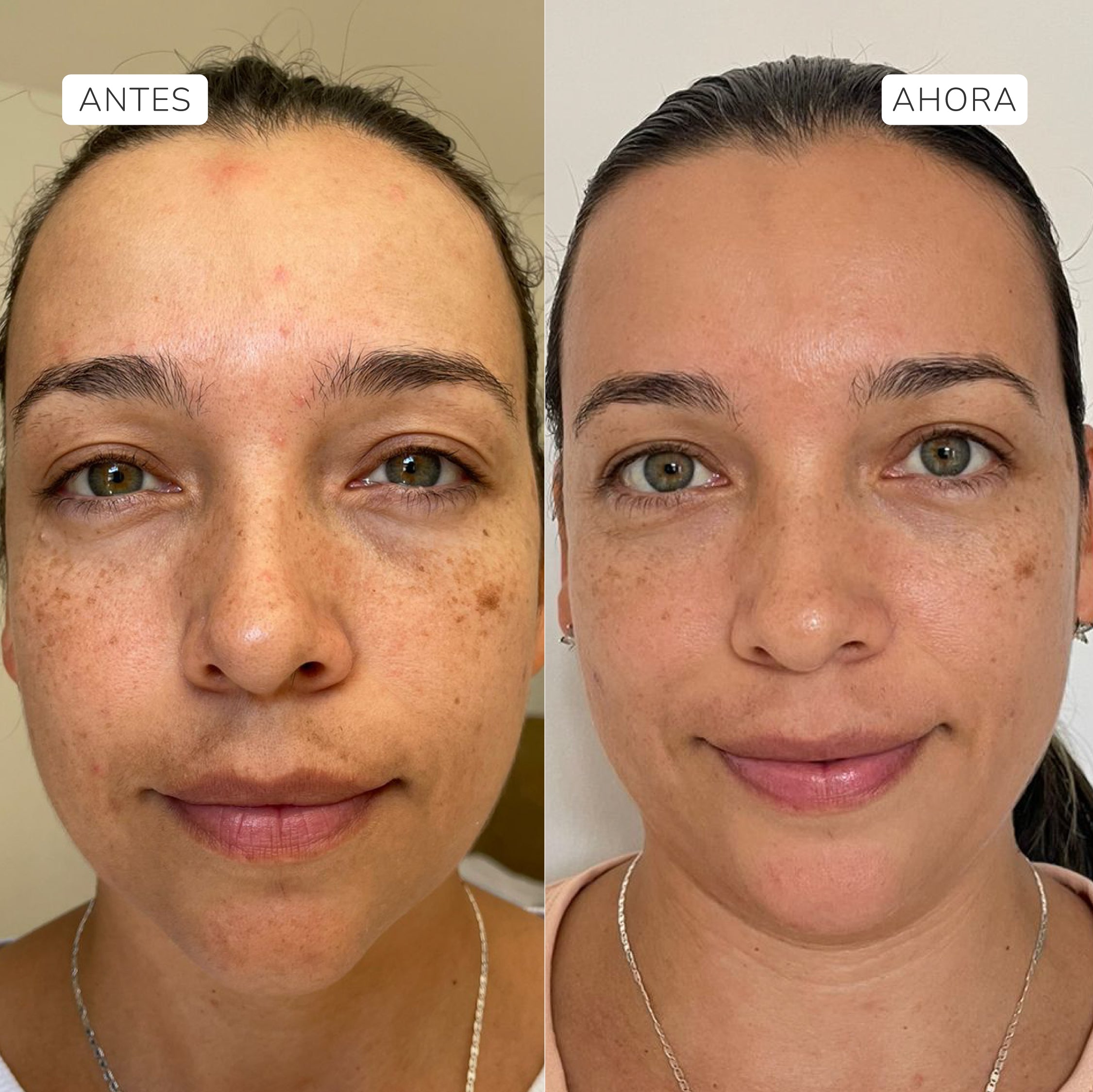 Serum facial intensivo Fito-retinol 30ml