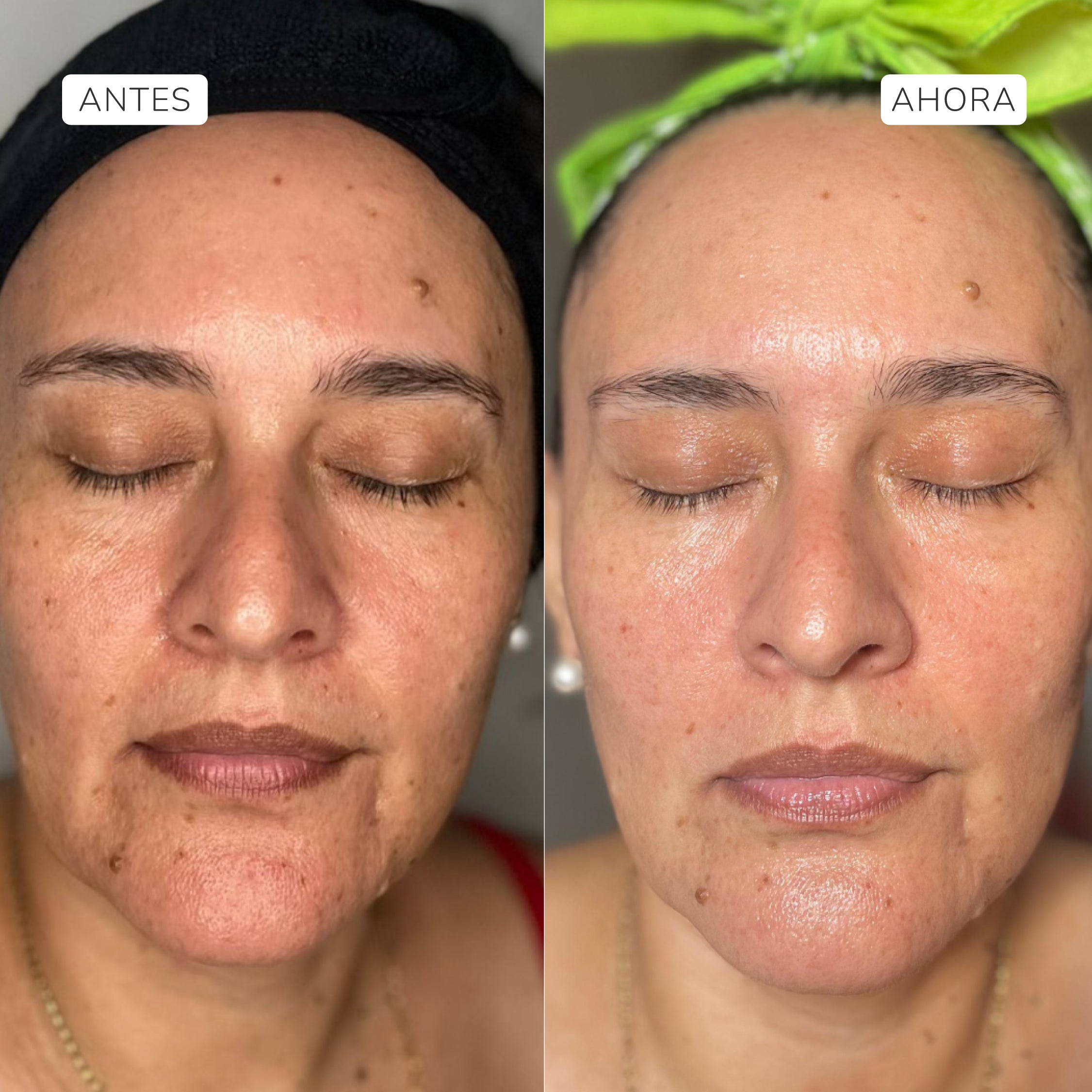 Serum facial RevitaC 30ml