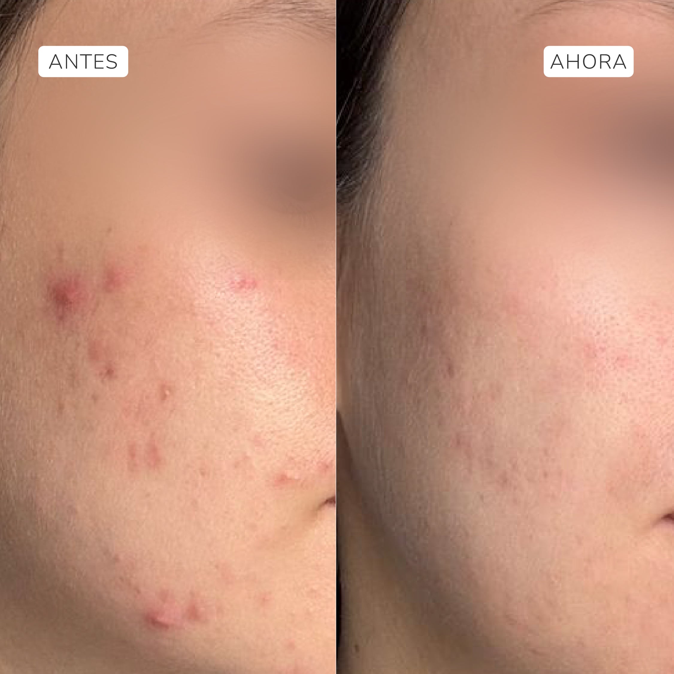 Sérum exfoliante ácido glicólico 4% y láctico 2,5% 30ml